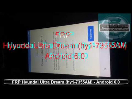 Hyundai ultra dream android root  -  updated April 2024